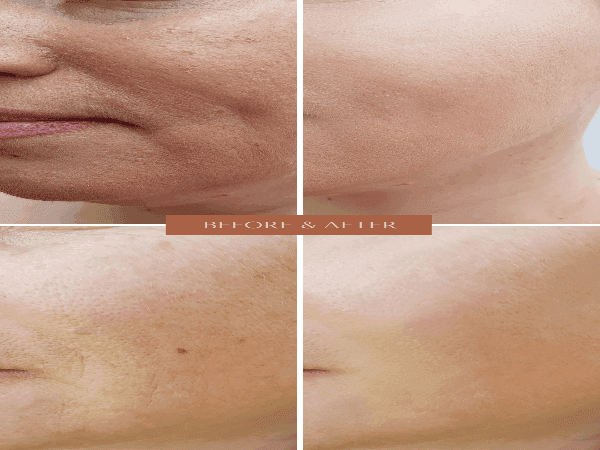 Organic Anti-Aging Facial Moisturizer with Chamomile -  For WOMEN